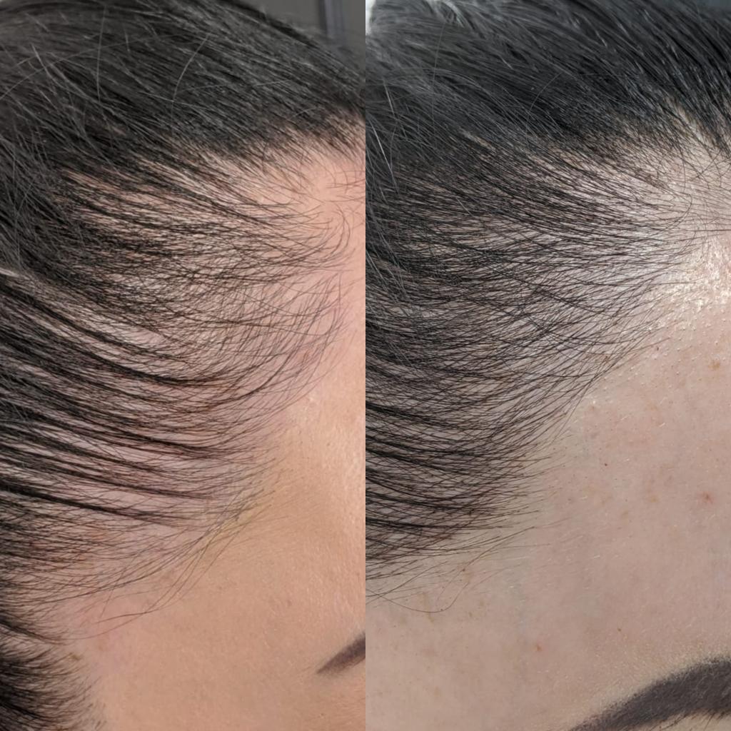 Microblading Antalya